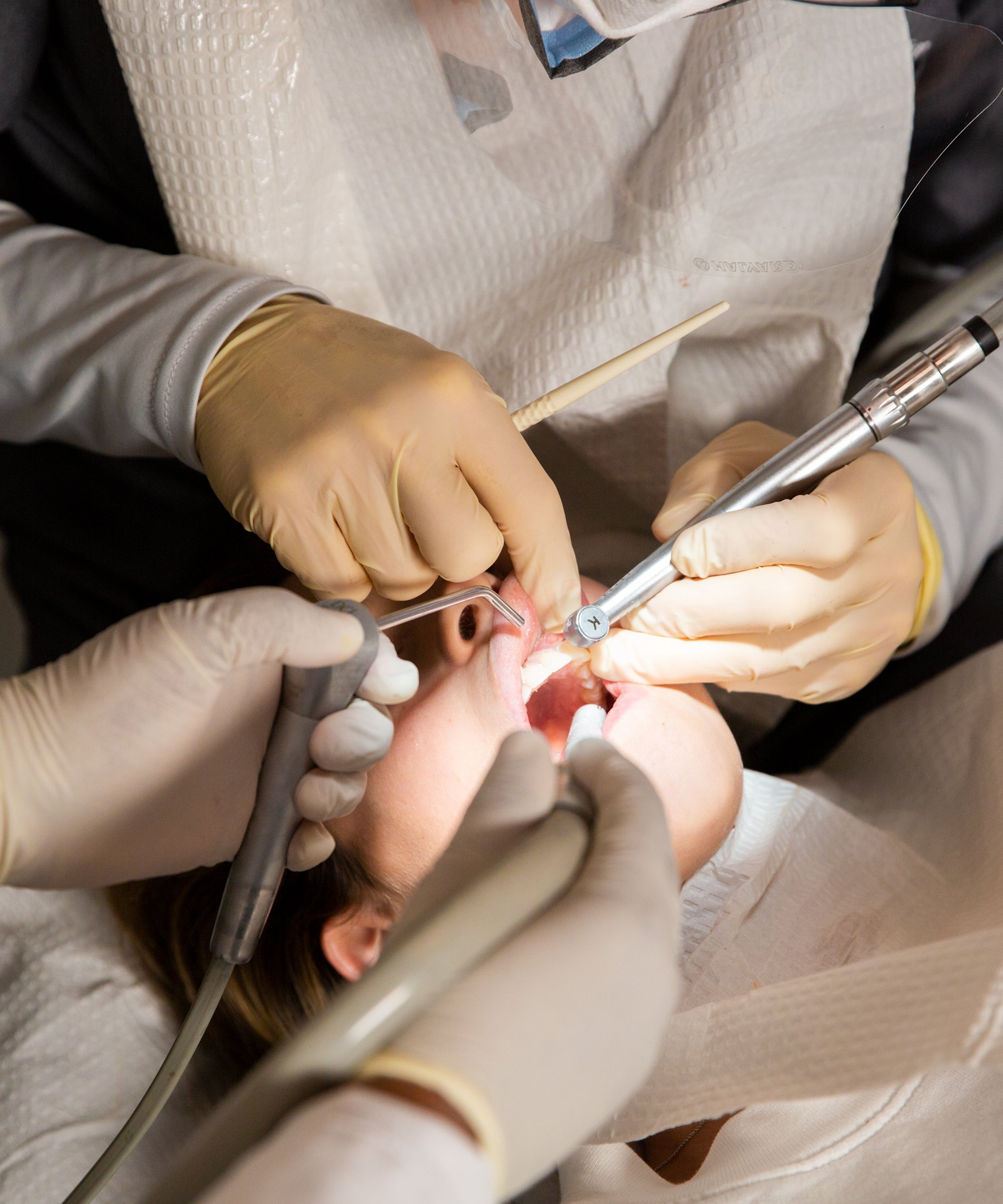 Refaire Ses Dents : Les 10 Techniques Expliquées Par Le Dr. Zisserman