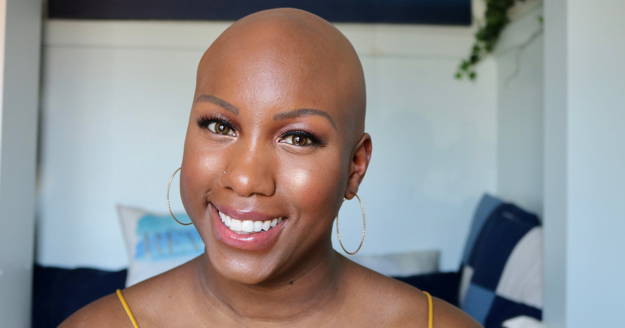 I Have Alopecia & Finally Black, Bald Beauty Is News