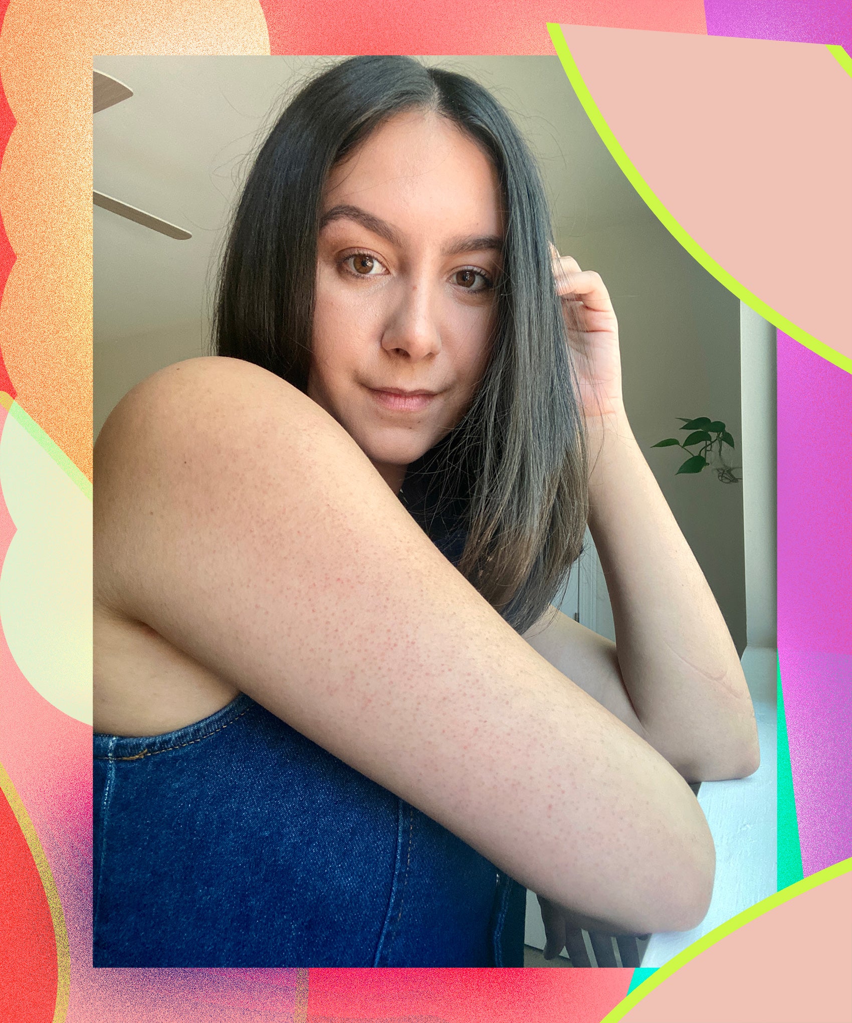 Keratosis Pilaris Made Me Hate Summer Fashion. Here’s Why That Changed