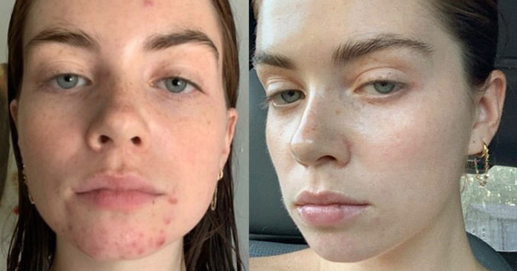 Good Skin Tips From NYC s