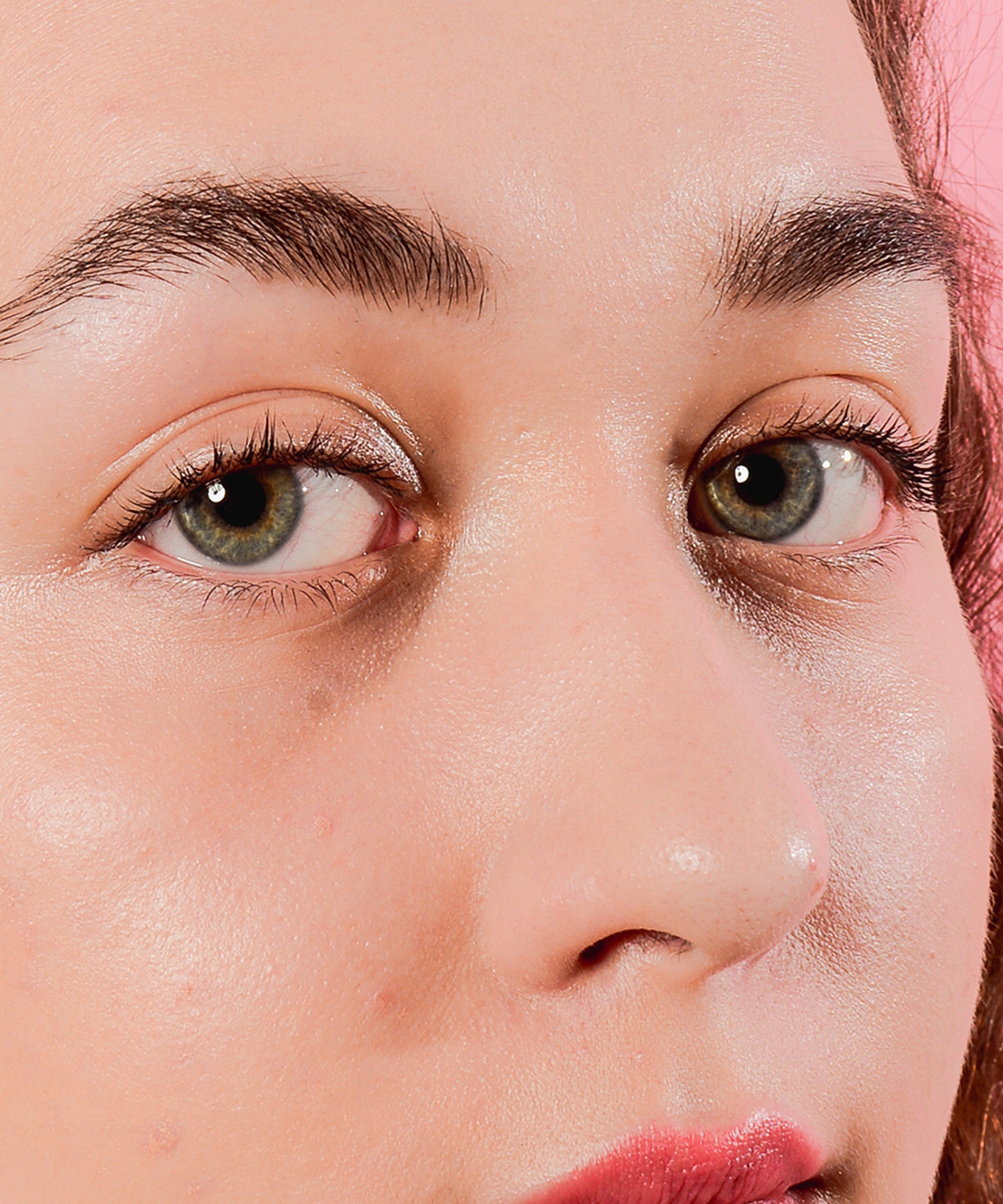 People on Social Media Are Using Eye Drops to Conceal Acne Redness
