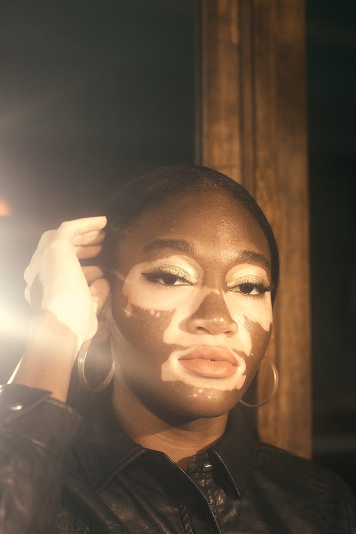 Brown Eyes Vitiligo Face Brown Skin Tone's Code & Price - RblxTrade